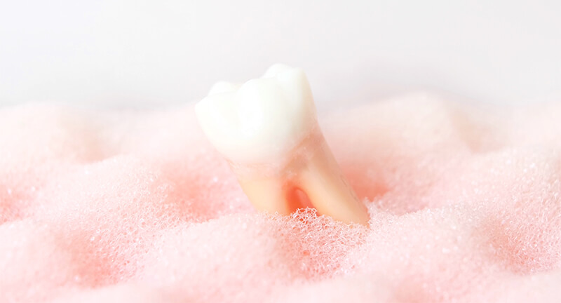 虫歯、歯周病治療に対応